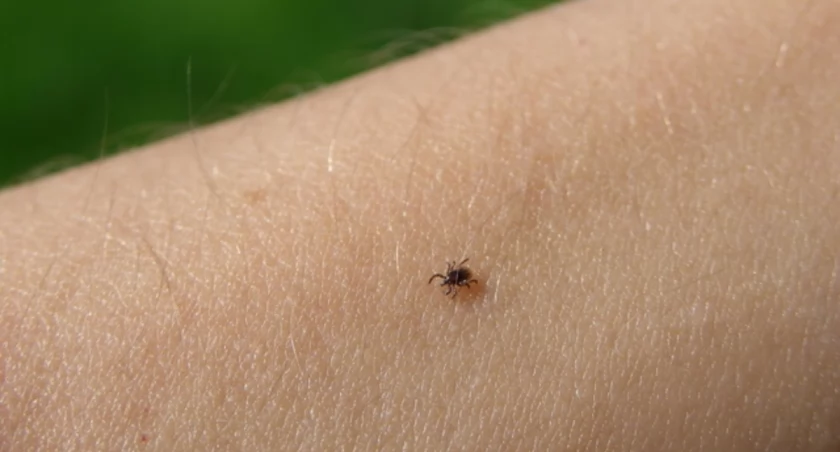 Kleszcze są bardzo niebezpieczne. W Podlaskiem to prawdziwa plaga