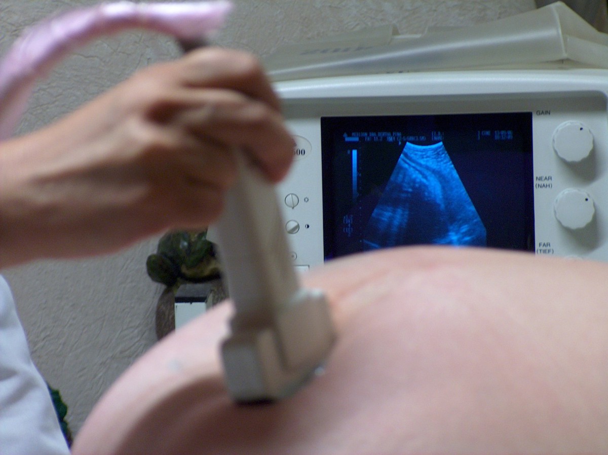 Baby Later, czyli jak zabezpieczyć się przed niepłodnością związaną z wiekiem