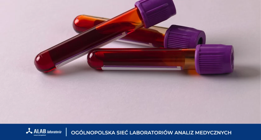 Morfologia krwi – podstawowe badanie w profilaktyce zdrowia. Kiedy je wykonać?