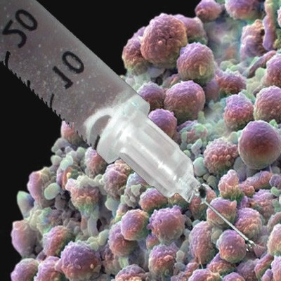 Koklusz. Zapomniana choroba powraca z siłą