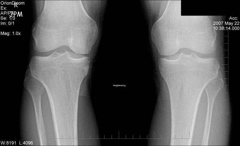 Odszkodowanie za błąd diagnostyczny