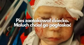 Pogryzienie trzyletniego dziecka w twarz. Pomocy udz…