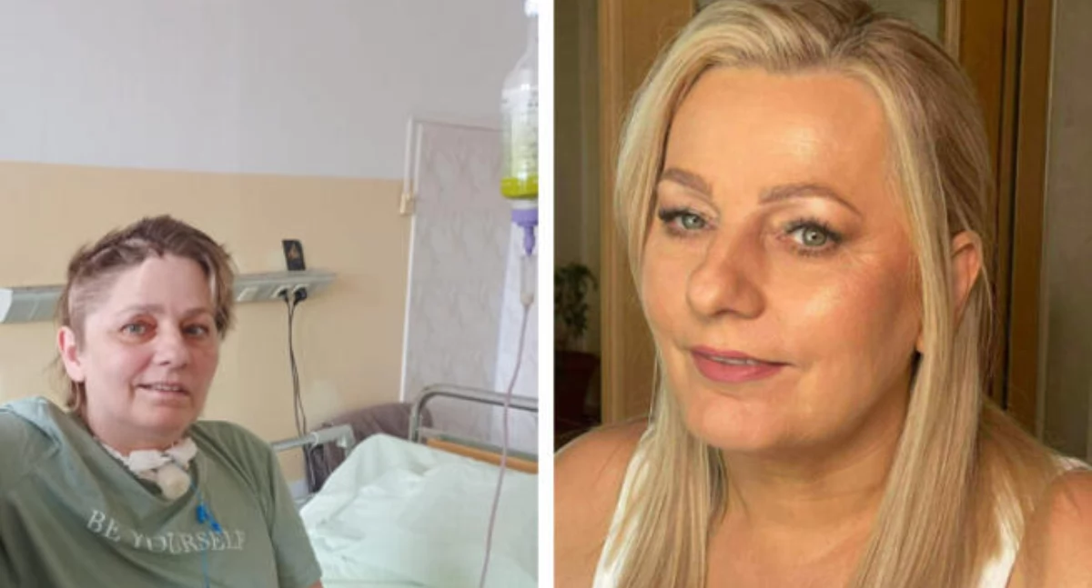 Ewa Siwak z Muniny walczy o powrót do sprawności po pęknięciu tętniaka. Liczy się każda pomoc, każda złotówka 