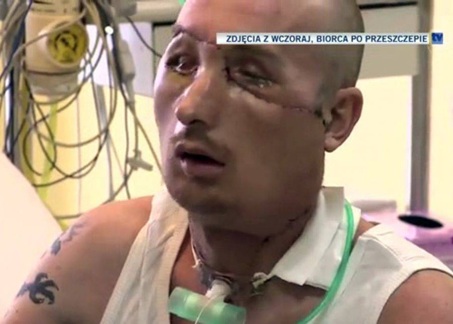 Matka: Oddałam twarz syna, by ratować życie innego człowieka- VIDEO