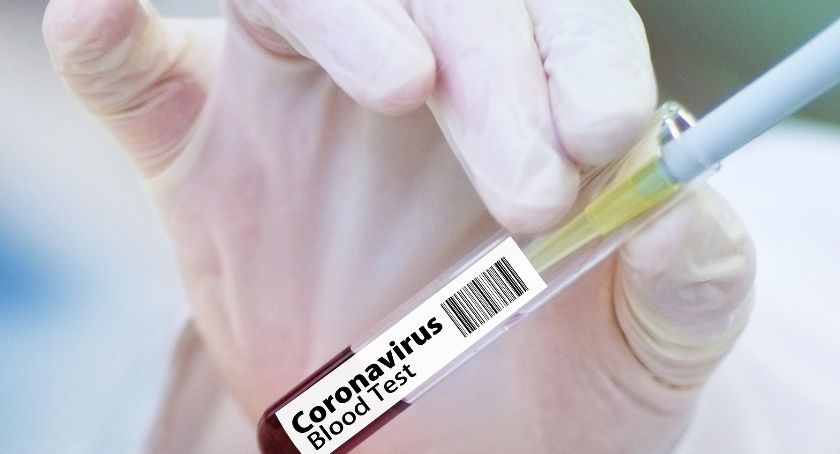 Koronawirus – Nowy komunikat PSSE w Garwolinie z 12 lipca