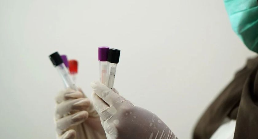 Laboratorium zablokowało przyjmowanie próbek – Duże opóźnienia z wynikami 