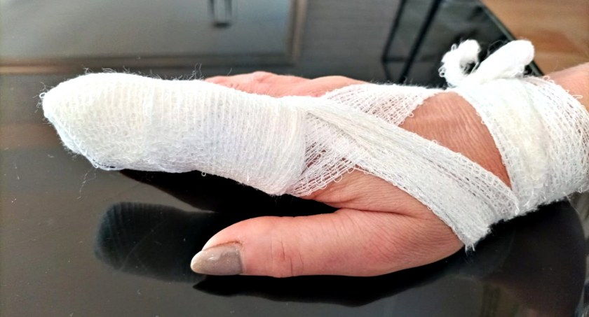 Poszarpał pieska, a kobiecie odgryzł palec! Mogło dojść do tragedii…