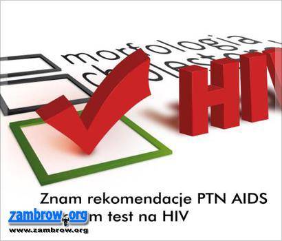 Problem HIV nadal aktualny