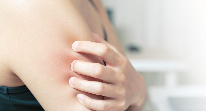 Wysypka – alergia i jej przyczyny
