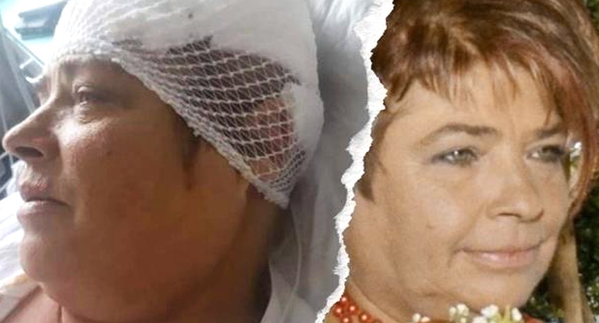 Jola Kolus przeszła operację mózgu 