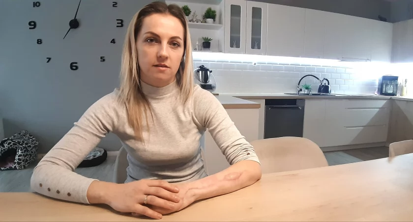 Metalowe walce zmiażdżyły jej dłoń