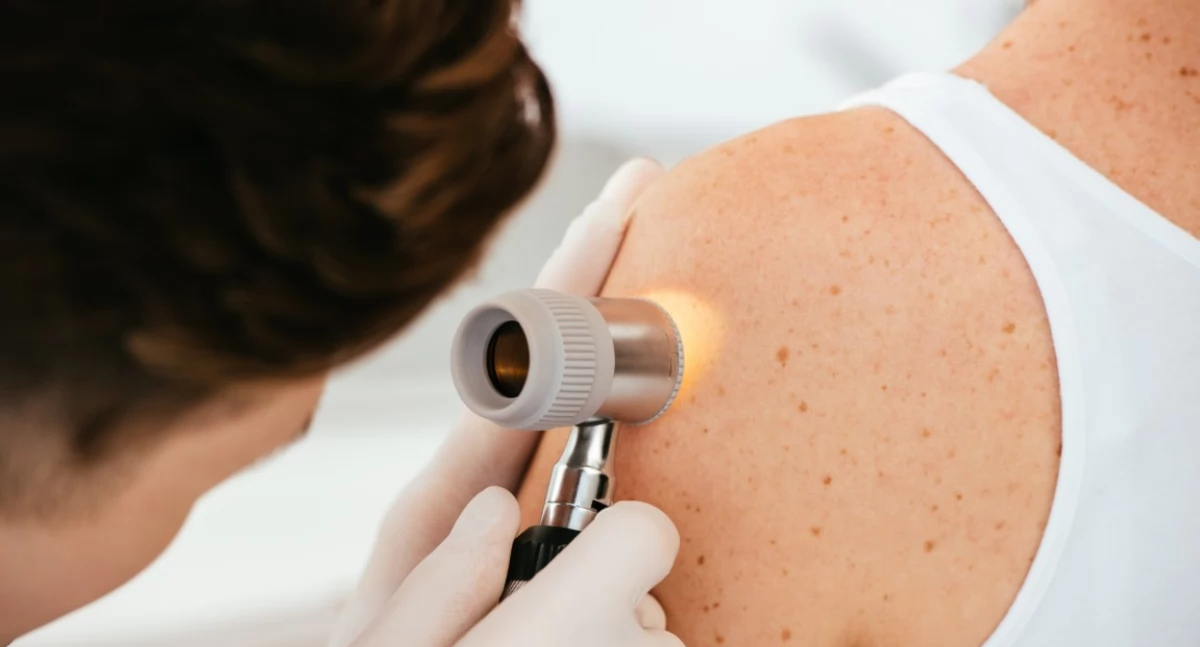 Jak wygląda pierwsza wizyta u dermatologa? Kompleksowy przewodnik dla Pań i Panów