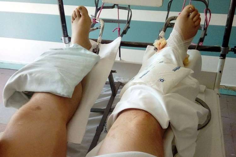 Koparką połamał mu nogi