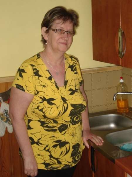 Poparzona olejem i ogniem