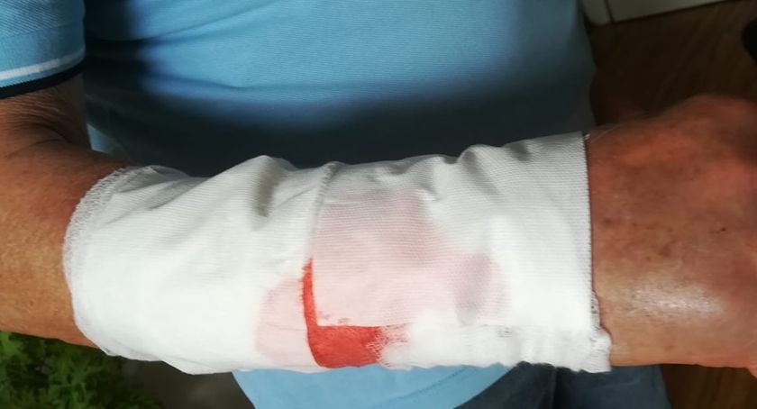 Jelenia Góra : Ciężko chory mężczyzna pogryziony przez psa