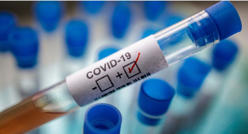 Testy potwierdziły diagnozę lekarza. Kolejny młody legniczanin z COVID-19