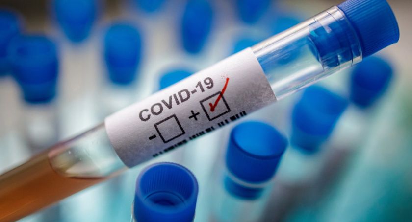 8 weselników i młody legniczanin z COVID-19. Wirus groźny też dla młodych 