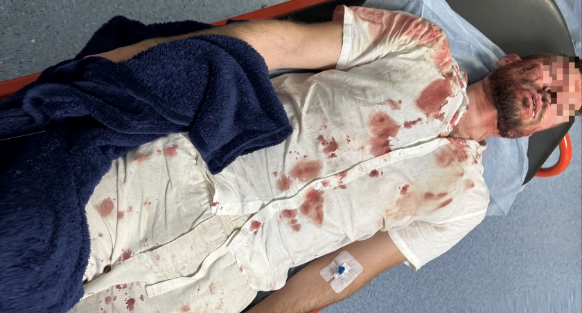 W Prochowicach omal nie zabito człowieka. Co na to policja?