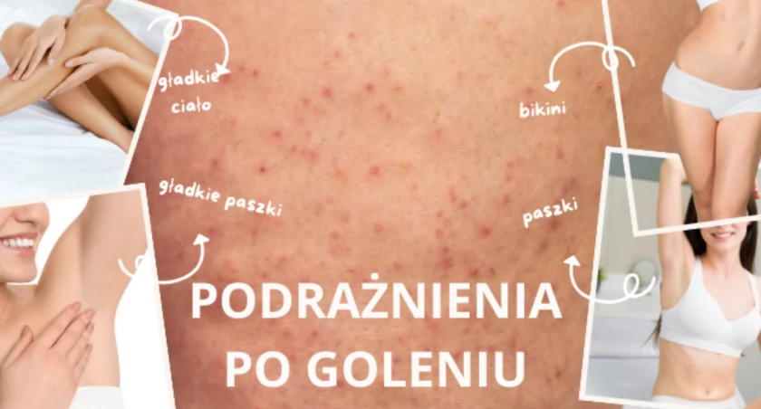 Moje doświadczenia z depilacją laserową