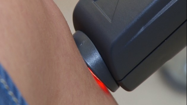 Laseroterapia