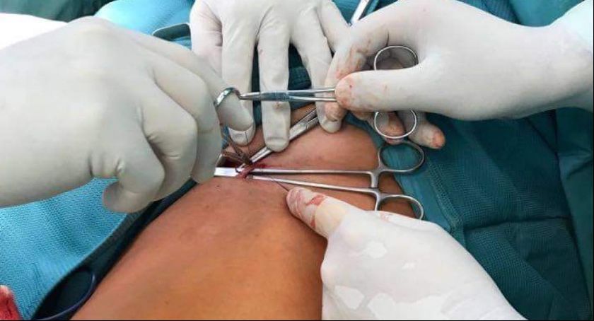 Operacje ,,po godzinach”. Szpital w Kaliszu nadrabia zaległości spowodowane pandemią koronawirusa 