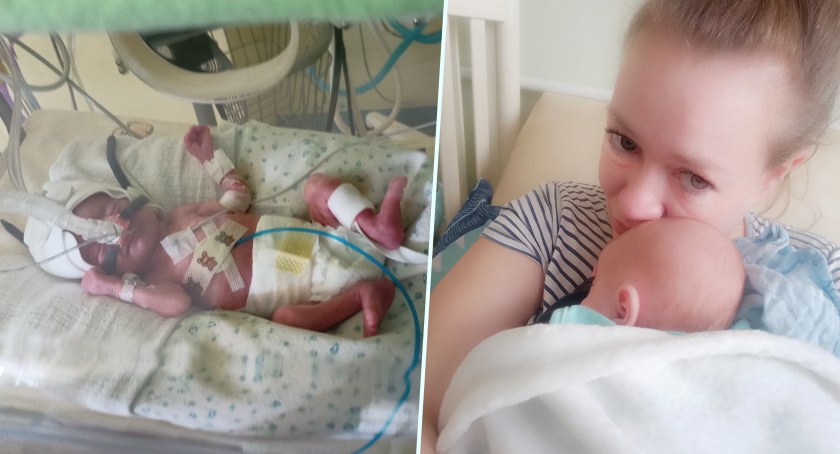Sylwek z Wiąga urodził się mając 930 gramów. Pomoc pilnie potrzebna