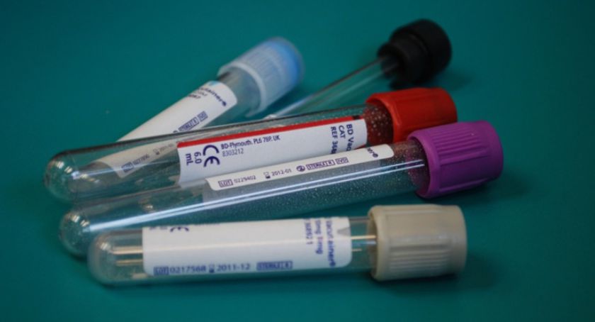 W Płocku, Słupnie, Gostyninie bezpłatne badania na HCV