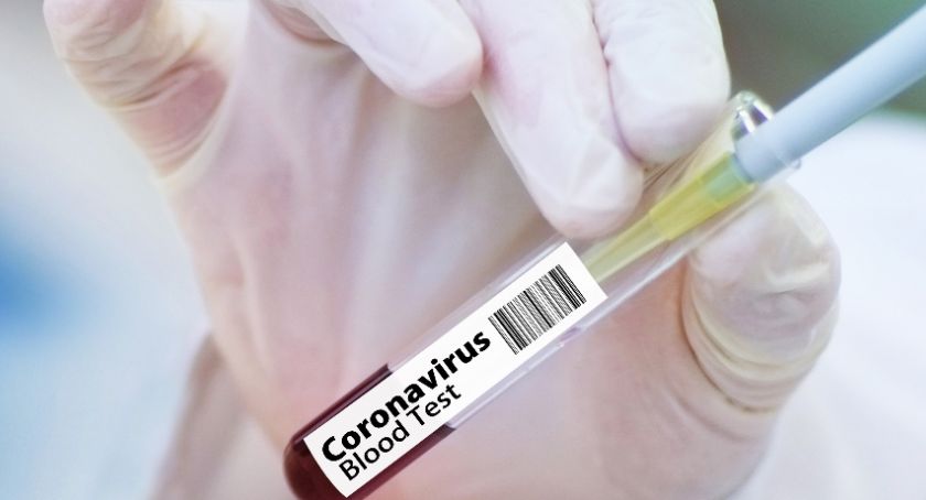To dobra wiadomość - 13 ozdrowieńców w województwie lubelskim