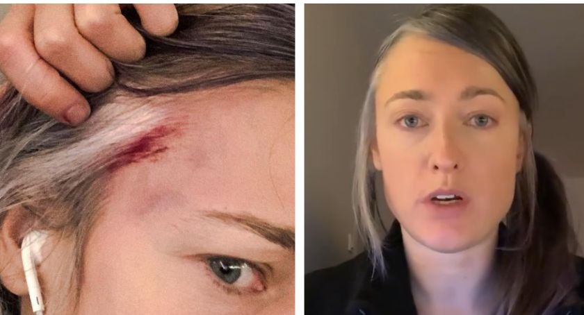 Matylda Damięcka POBITA przez policjanta? Aktorka pokazała wstrząsające nagranie