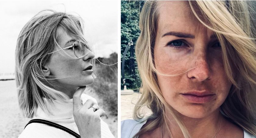 Edyta Pazura od lat walczy z chorobą. Pokazała niepokojące przebarwienia