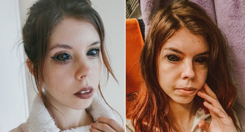 Wytatuowana fanka Popka jest w dramatycznej sytuacji. ZUS nie przyznał jej renty