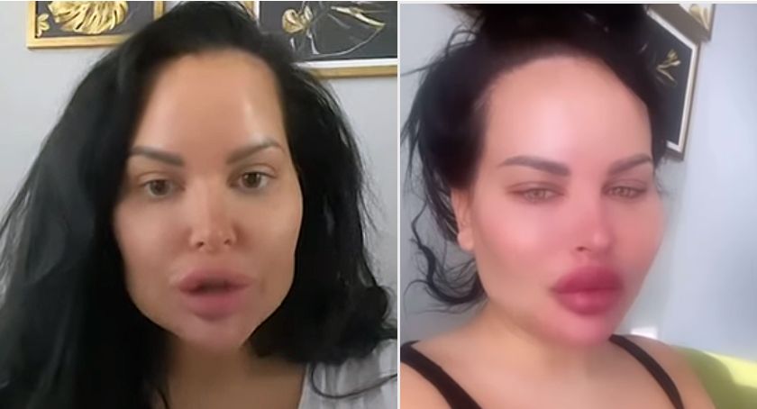 Esmeralda Godlewska zamknięta w szpitalu psychiatrycznym. Co dzieje się z celebrytką?