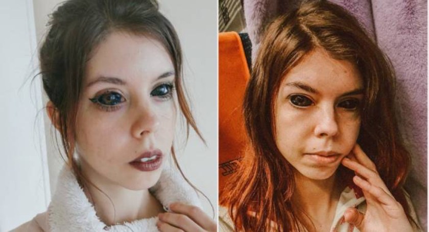 Fanka Popka z wytatuowanymi oczami wygrała sprawę sądową z tatuażystą