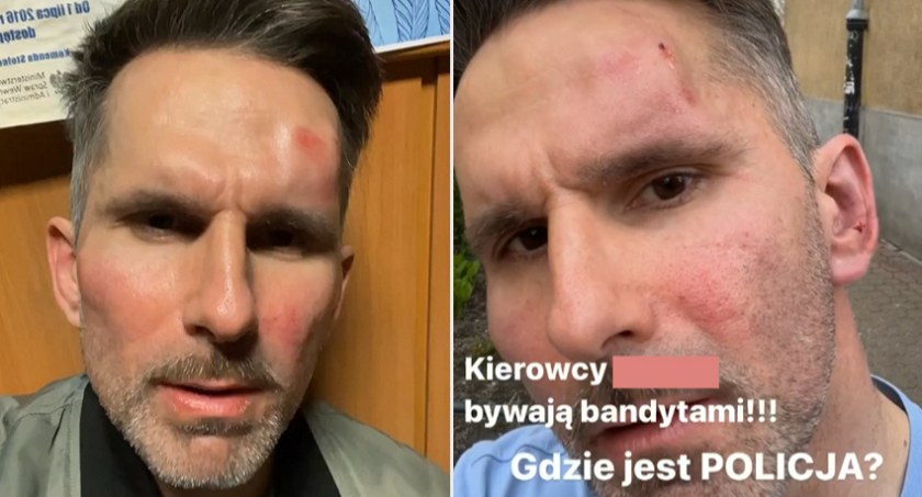 Marcin Bosak został brutalnie pobity. Był z młodszym synem