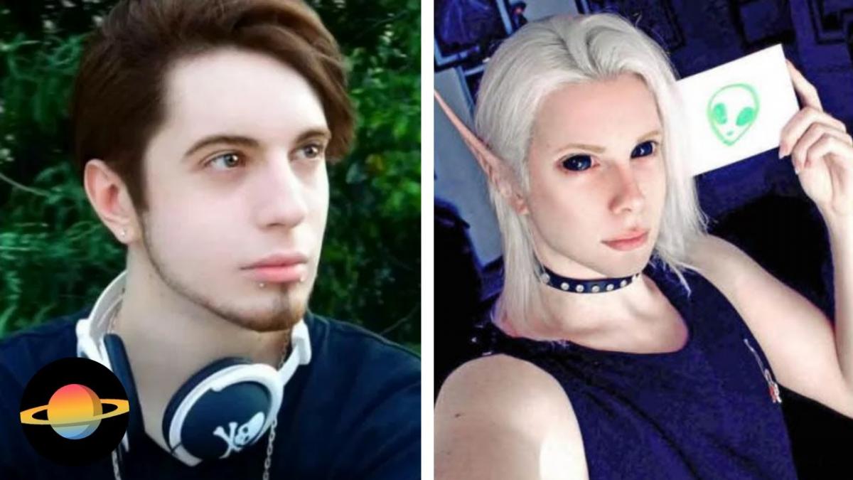10 szokujących operacji, które kompletnie zmieniły ludzką twarz