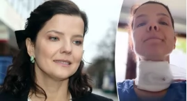 Joanna Jabłczyńska pokazała się z obandażowaną szyją&hellip;