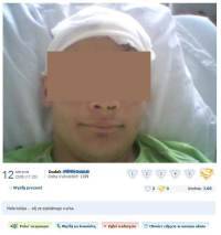 Szok - chłopak, który przeżył wypadek kpi z tragedii