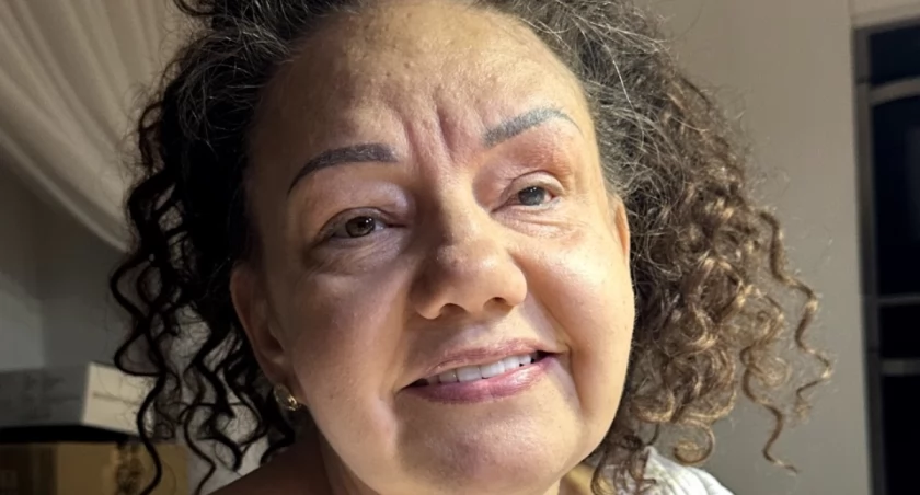 Marzena Brzeska walczy o odzyskanie wzroku i zdrowie - potrzebne wsparcie