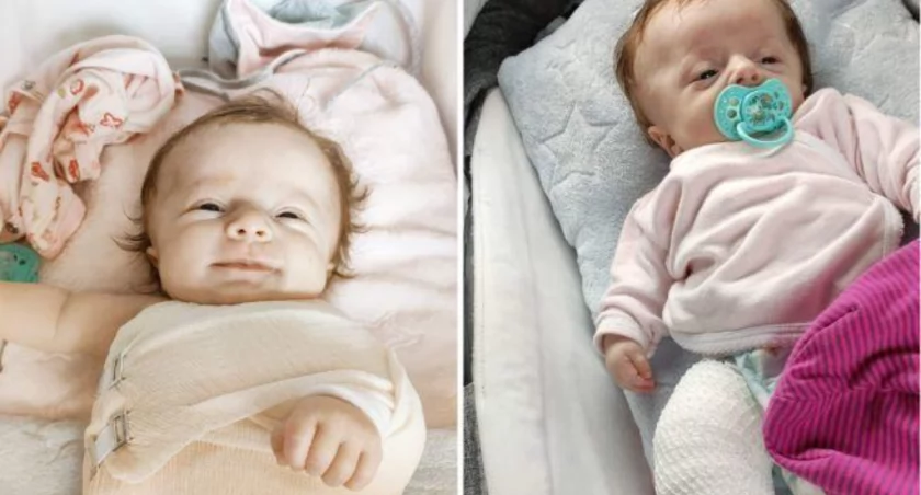 Każdy dotyk grozi kolejnym złamaniem! 1,5 roczna Nadia pilnie potrzebuje leczenia!