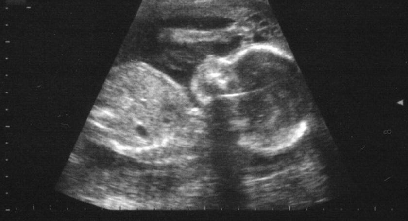 Para z Kartuz dorabiała na aborcjach