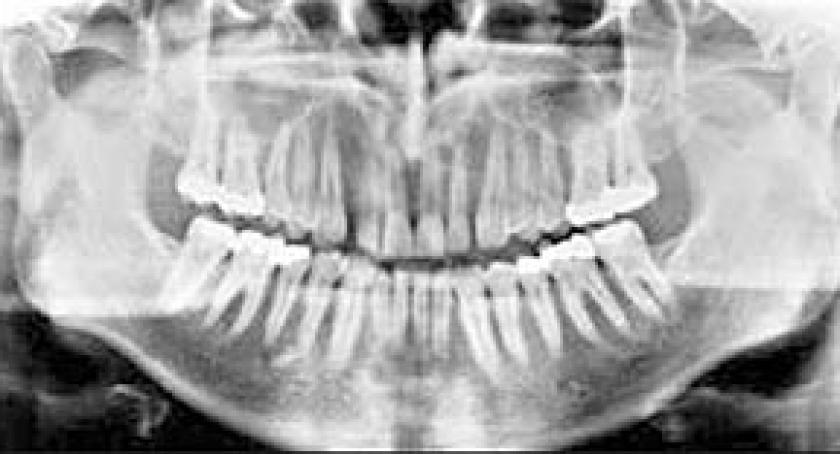 Uśmiechają się do... rentgena. Sesje zdjęciowe u dentysty