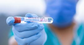 10 nowych ozdrowień na Pomorzu - już 424 osoby pokonały chorobę