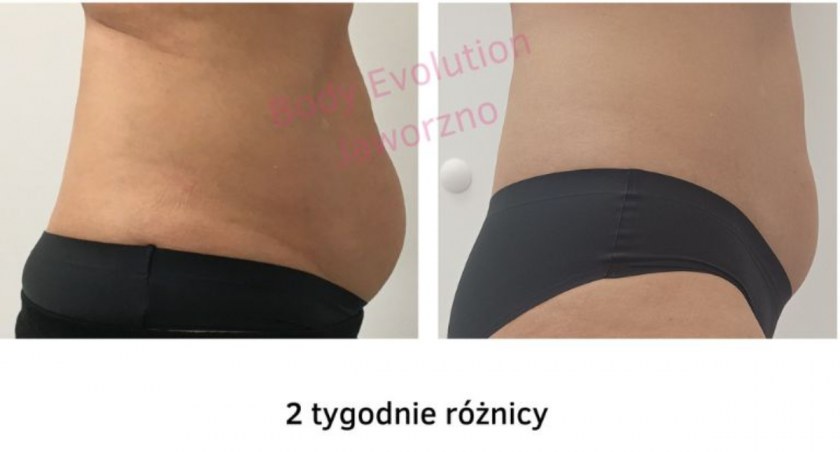Masz wystające boczki ze spodni? Albo fałdki na plecach? Twoje uda ocierają się o siebie?