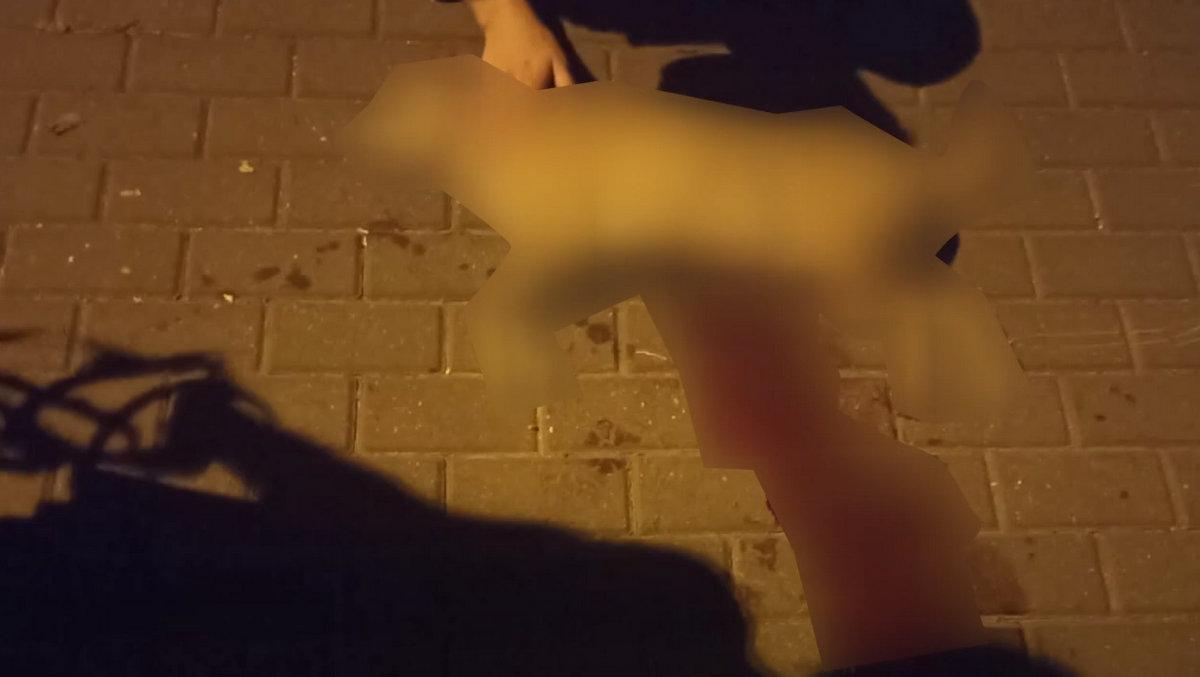Agresywny pies z Podwala nie był szczepiony! Policja odnalazła opiekuna agresywnego zwierzęcia