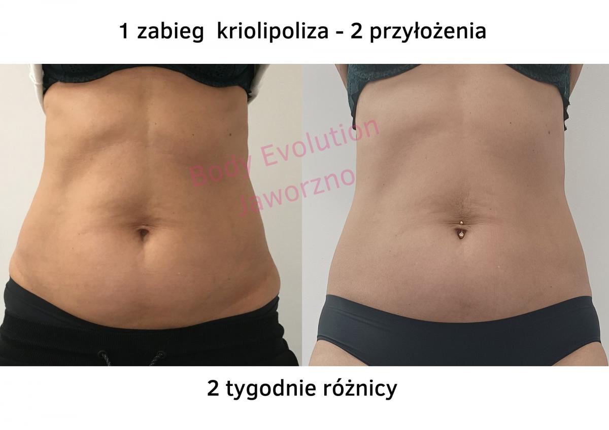 Sezon na przygotowania sylwetki do wakacji rozpoczęty!