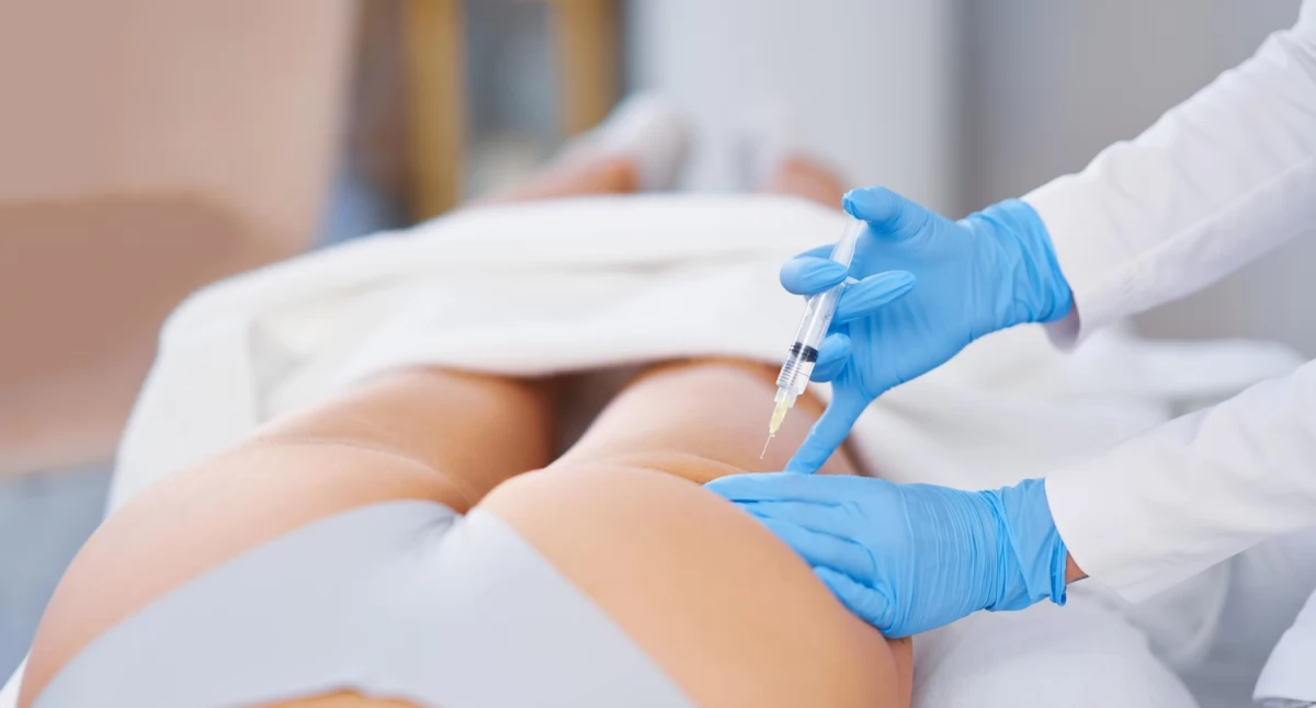 Modelowanie pośladków biostymulatorami – innowacyjna metoda kształtowania sylwetki