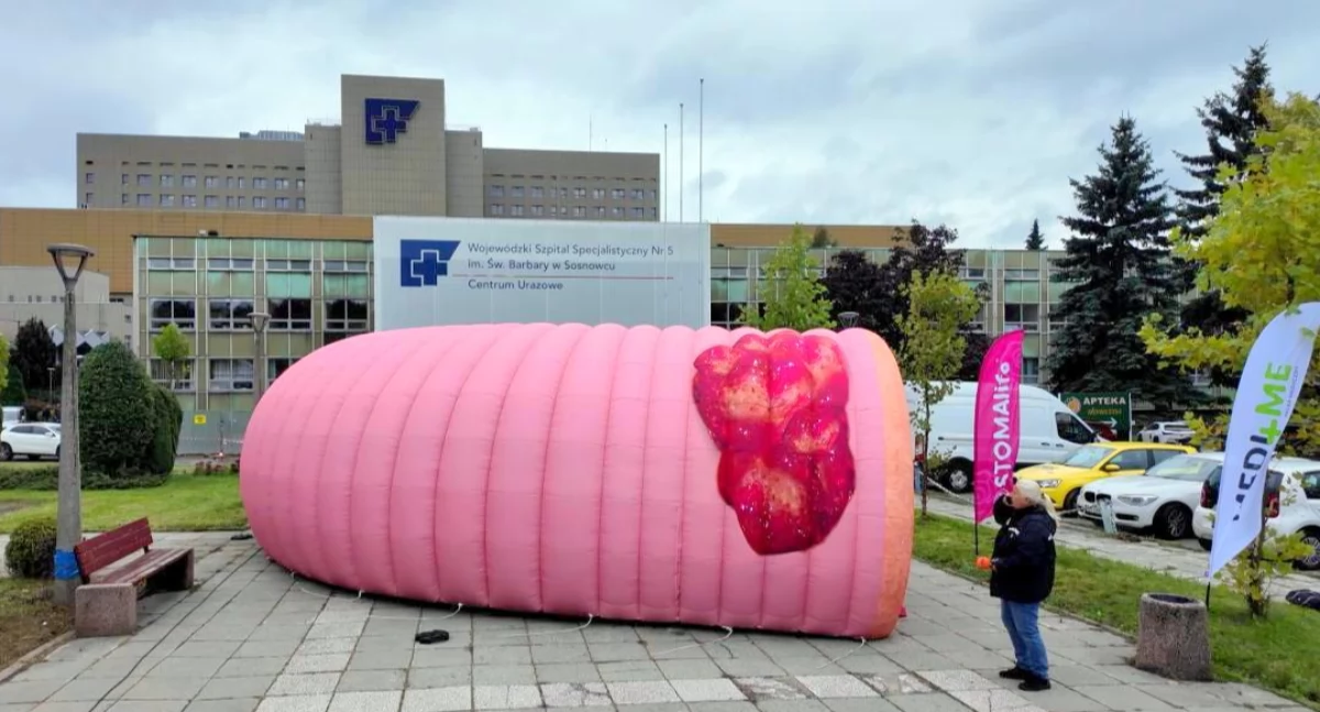 Gigantyczne jelito 3D stanęło przed szpitalem w Sosnowcu