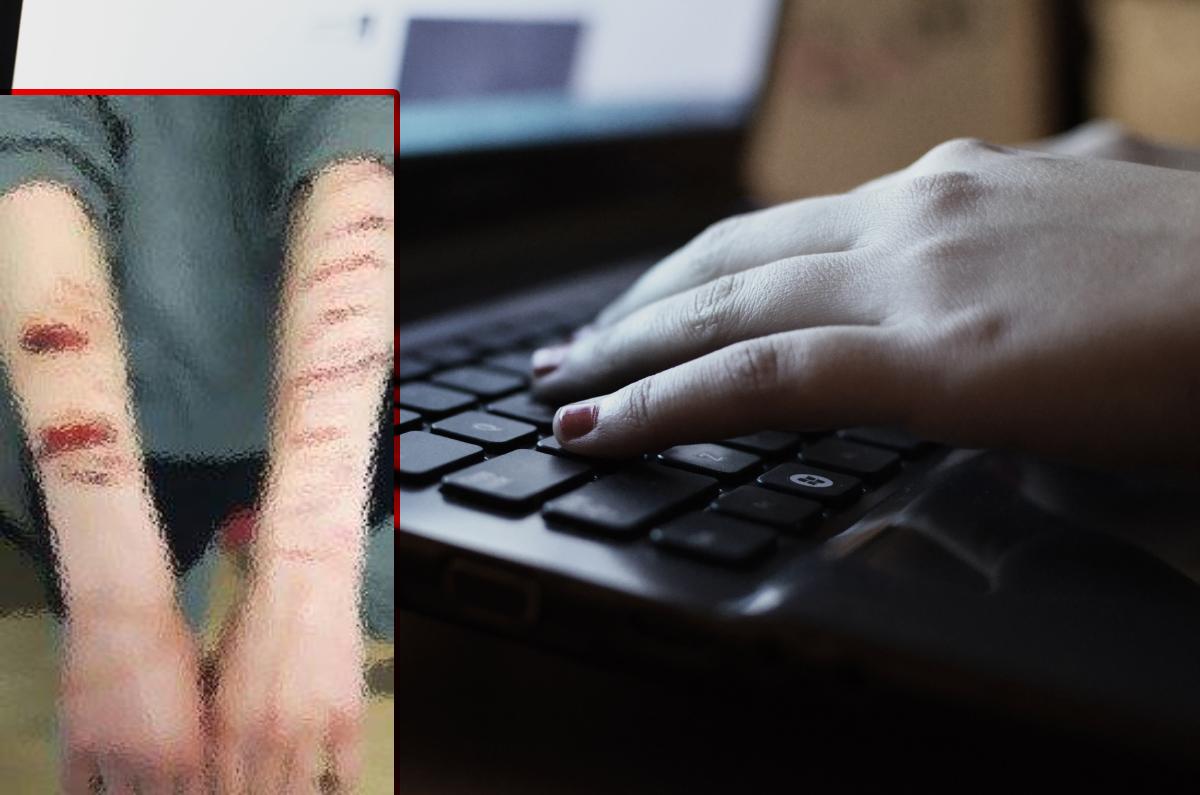 Niebezpieczna gra - Niebieski wieloryb - w województwie śląskim
