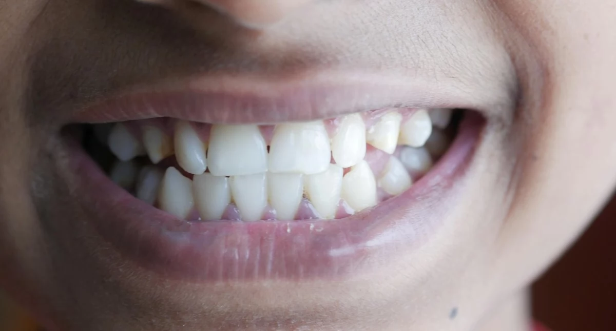 Dlaczego plan leczenia u dentysty wygląda tak różnie?