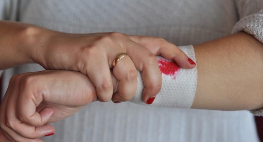 Powiat. Coraz więcej przypadków pokąsań przez psy. Strażnicy apelują o ostrożność